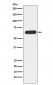 Anti-CD89 Rabbit Monoclonal Antibody