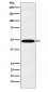 Anti-IL13 receptor alpha 1 Rabbit Monoclonal Antibody