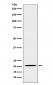 Anti-IL23 Rabbit Monoclonal Antibody