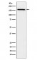 Anti-ADAMTS13 Rabbit Monoclonal Antibody