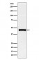 Anti-Pentraxin 3 Rabbit Monoclonal Antibody