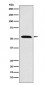 Anti-Retinoid X Receptor alpha Rabbit Monoclonal Antibody