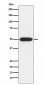 Anti-PRKAR1A Rabbit Monoclonal Antibody