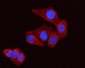 Anti-Lumican Rabbit Monoclonal Antibody