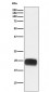 Anti-Mammaglobin A Rabbit Monoclonal Antibody