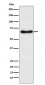 Anti-CYP24A1 Rabbit Monoclonal Antibody