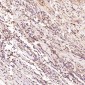Anti-H Cadherin Rabbit Monoclonal Antibody