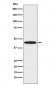 Anti-DDB2 Rabbit Monoclonal Antibody