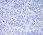 Anti-TBX21 Rabbit Monoclonal Antibody