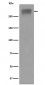 Anti-Thyroglobulin Rabbit Monoclonal Antibody