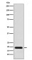 Anti-NM23 Rabbit Monoclonal Antibody