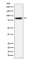 Anti-CD105 Rabbit Monoclonal Antibody