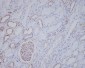 Anti-ALK Rabbit Monoclonal Antibody