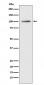 Anti-ATP2A1/SERCA1 Rabbit Monoclonal Antibody