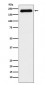 Anti-ATAD2 Rabbit Monoclonal Antibody