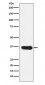 Anti-LDHA Rabbit Monoclonal Antibody