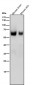 Anti-USP22 Rabbit Monoclonal Antibody