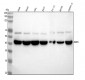 Anti-BMP6 Rabbit Monoclonal Antibody