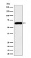 Anti-SQSTM1 / p62 Rabbit Monoclonal Antibody