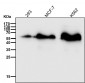 Anti-SQSTM1 / p62 Rabbit Monoclonal Antibody