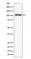 Anti-ACTN3 Rabbit Monoclonal Antibody