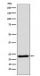 Anti-RAIDD Rabbit Monoclonal Antibody