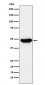 Anti-ENTPD5 Rabbit Monoclonal Antibody