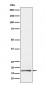 Anti-GCDFP 15 Rabbit Monoclonal Antibody