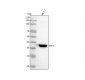 Anti-FBP1 Rabbit Monoclonal Antibody