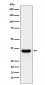 Anti-PSMD14 Rabbit Monoclonal Antibody