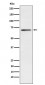 Anti-Plastin L Rabbit Monoclonal Antibody