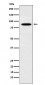 Anti-EWSR1 Rabbit Monoclonal Antibody