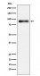 Anti-Lactoferrin Rabbit Monoclonal Antibody
