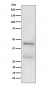 Anti-MBD2 Rabbit Monoclonal Antibody