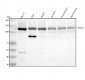 Anti-TYRO3 Rabbit Monoclonal Antibody