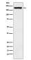 Anti-MRC2/ENDO180 Rabbit Monoclonal Antibody