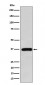 Anti-FBP1 Rabbit Monoclonal Antibody