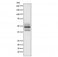 Anti-SKP2 Rabbit Monoclonal Antibody
