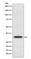 Anti-IGFBP1 Rabbit Monoclonal Antibody