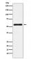 Anti-CBX2 Rabbit Monoclonal Antibody