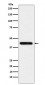 Anti-Cystathionase Rabbit Monoclonal Antibody