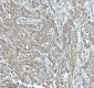 Anti-PAR2 Rabbit Monoclonal Antibody