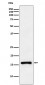 Anti-CDKN2C Rabbit Monoclonal Antibody