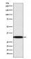 Anti-REA Rabbit Monoclonal Antibody