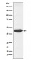Anti-IDH1 Rabbit Monoclonal Antibody