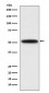 Anti-DGAT1 Rabbit Monoclonal Antibody