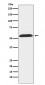 Anti-TXNRD2 Rabbit Monoclonal Antibody