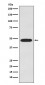 Anti-Galactosidase alpha Rabbit Monoclonal Antibody