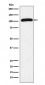 Anti-ROR2 Rabbit Monoclonal Antibody