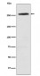 Anti-CAD Rabbit Monoclonal Antibody